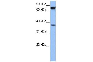 ZCCHC12 antibody used at 1 ug/ml to detect target protein. (ZCCHC12 抗体  (N-Term))