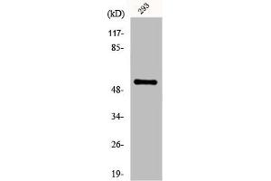 Western Blot analysis of 293 cells using Fgl2 Polyclonal Antibody (FGL2 抗体  (N-Term))