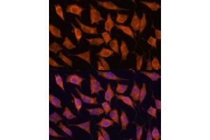 Immunofluorescence analysis of L929 cells using KIF13A antibody (ABIN7268122) at dilution of 1:100. (KIF13A 抗体  (AA 1300-1600))