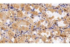 Immunohistochemistry (IHC) image for anti-Interleukin 13 Receptor, alpha 2 (IL13RA2) (AA 238-334) antibody (ABIN7437515)
