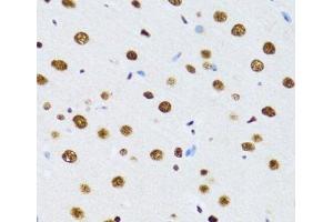Immunohistochemistry (Paraffin-embedded Sections) (IHC (p)) image for anti-DEAD (Asp-Glu-Ala-Asp) Box Polypeptide 39B (DDX39B) antibody (ABIN7264385)