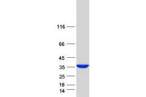 Western Blotting (WB) image for Sulfotransferase Family, Cytosolic, 1C, Member 2 (SULT1C2) (Transcript Variant 1) protein (Myc-DYKDDDDK Tag) (ABIN2732959)