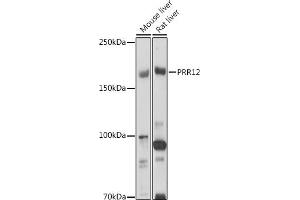 Western blot analysis of extracts of various cell lines, using PRR12 antibody (ABIN7269553) at 1:1000 dilution. (Proline Rich 12 抗体)