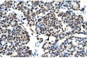 Human Pancrease lysate (HOXB5 抗体  (N-Term))