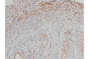 Immunohistochemistry (IHC) image for anti-Cofilin 1 (CFL1) (pSer3) antibody (ABIN6255180)