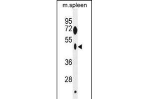ZNF385C Antibody (N-term) (ABIN655429 and ABIN2844966) western blot analysis in mouse spleen tissue lysates (35 μg/lane). (ZNF385C 抗体  (N-Term))