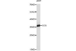 Western blot analysis of extracts of 293T cells, using CCS antibody (ABIN2561651) at 1:1000 dilution.