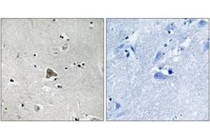 Immunohistochemistry analysis of paraffin-embedded human brain tissue, using Claudin 4 (Ab-208) Antibody. (Claudin 4 抗体  (AA 160-209))