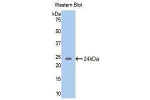 Western Blotting (WB) image for anti-Glutamate Decarboxylase 2 (Pancreatic Islets and Brain, 65kDa) (GAD2) (AA 188-374) antibody (ABIN1858943) (GAD65 抗体  (AA 188-374))