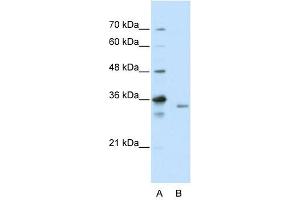 EXOSC3 antibody used at 2. (EXOSC3 抗体  (C-Term))