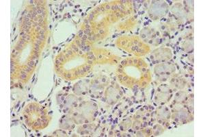 Immunohistochemistry (IHC) image for anti-Transforming Growth Factor beta Regulator 1 (TBRG1) (AA 22-150) antibody (ABIN7172813)