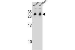 Western blot analysis in mouse lung/spleen tissue lysates (35ug/lane) using CYB561D1 Antibody . (CYB561D1 抗体  (C-Term))