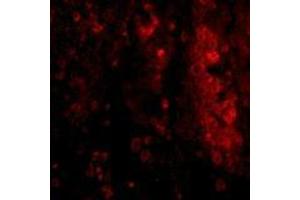 Immunofluorescence of IL-33 in human lymph node tissue with AP30426PU-N IL-33 antibody at 20 μg/ml. (IL-33 抗体  (N-Term))