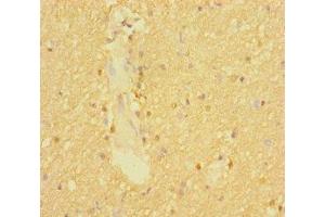 Immunohistochemistry of paraffin-embedded human brain tissue using ABIN7170007 at dilution of 1:100 (SLC6A7 抗体  (AA 557-636))