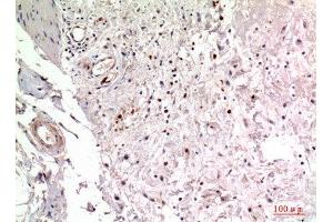 Immunohistochemistry (IHC) analysis of paraffin-embedded Human Colon, antibody was diluted at 1:100. (ITGA2 抗体  (Internal Region))