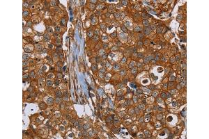 Immunohistochemistry (IHC) image for anti-Plectin (PLEC) antibody (ABIN2433604) (PLEC 抗体)