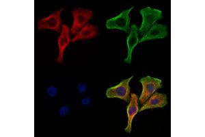 ABIN6266273 and ABIN6277461 staining Hela cells by IF/ICC. (SSTR2 抗体  (C-Term))