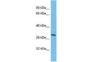 Host: Rabbit Target Name: TMEM202 Sample Type: HepG2 Whole Cell lysates Antibody Dilution: 1. (TMEM202 抗体  (C-Term))