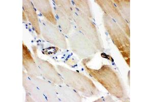 Anti-IRS1 antibody, (ABIN3043251), IHC(P)IHC(P): Rat Skeletal Muscle Tissue