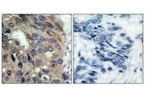 Immunohistochemistry (IHC) image for anti-Proto-oncogene tyrosine-protein kinase Src (Src) (pTyr529) antibody (ABIN7139020)