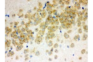 Anti- Otoferlin Picoband antibody,IHC(P) IHC(P): Mouse Brain Tissue (Otoferlin 抗体  (C-Term))