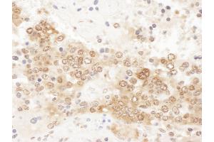 Immunohistochemistry (IHC) image for anti-Chloride Channel, Nucleotide-Sensitive, 1A (CLNS1A) (AA 187-237) antibody (ABIN7455042) (CLNS1A 抗体  (AA 187-237))