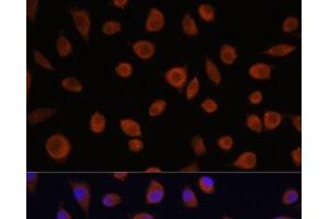 Immunofluorescence analysis of L929 cells using ZCCHC3 Polyclonal Antibody at dilution of 1:100. (ZCCHC3 抗体)