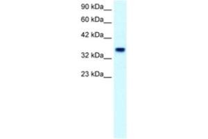 Western Blotting (WB) image for anti-Forkhead Box F1 (FOXF1) antibody (ABIN2460416) (FOXF1 抗体)