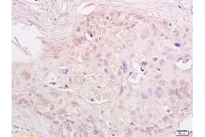 Immunohistochemistry (IHC) image for anti-Metastasis Associated 1 (MTA1) (AA 601-715) antibody (ABIN686182)