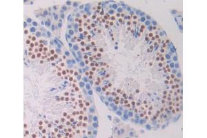 Used in DAB staining on fromalin fixed paraffin- embedded testis tissue (DTYMK 抗体  (AA 43-190))