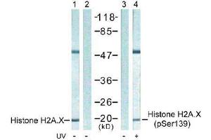 Image no. 1 for anti-H2A Histone Family, Member X (H2AFX) (pSer139) antibody (ABIN197033) (H2AFX 抗体  (pSer139))