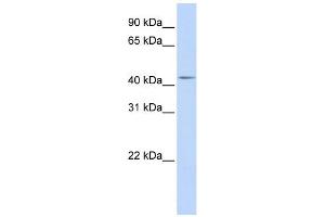 WB Suggested Anti-DENND1B Antibody Titration: 0. (DENND1B 抗体  (Middle Region))