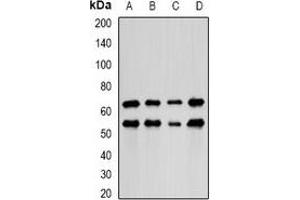 Western blot analysis of LIM expression in HepG2 (A), MCF7 (B), mouse lung (C), mouse kidney (D) whole cell lysates. (PDLIM5 抗体)
