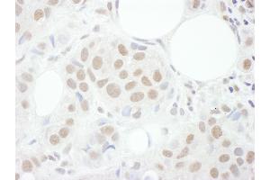 anti-Cyclin T1 (CCNT1) (AA 325-375) antibody