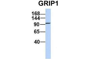 Host:  Rabbit  Target Name:  GRIP1  Sample Type:  721_B  Antibody Dilution:  1. (GRIP1 抗体  (C-Term))