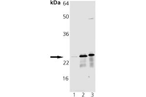Western blot analysis of MnSOD pAb: Lane 1: HeLa Cell Lysate, Lane 2: Rat Brain Tissue Extract, Lane 3: Mouse Brain Tissue Extract (SOD2 抗体)