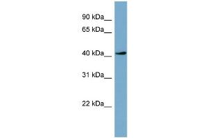 WB Suggested Anti-TSSK2  Antibody Titration: 0. (TSSK2 抗体  (Middle Region))