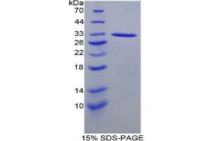 SDS-PAGE analysis of Mouse ACP5 Protein.