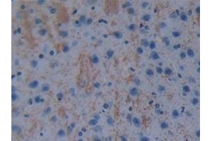 Detection of GSTt1 in Mouse Cerebrum Tissue using Polyclonal Antibody to Glutathione S Transferase Theta 1 (GSTt1) (GSTT1 抗体  (AA 7-240))