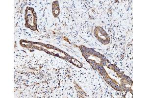 IHC analysis of ECSIT using anti-ECSIT antibody (ABIN7602543).