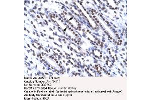 Human kidney (XRCC6 抗体  (N-Term))