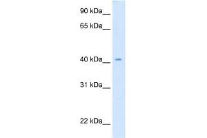 WB Suggested Anti-cad Antibody Titration:  0. (CAD 抗体  (Middle Region))