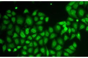 Immunofluorescence analysis of HeLa cells using AKR1A1 Polyclonal Antibody (AKR1A1 抗体)