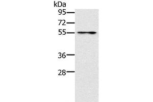 Western Blot analysis of Mouse intestinum tenue tissue using PUS10 Polyclonal Antibody at dilution of 1:200 (PUS10 抗体)