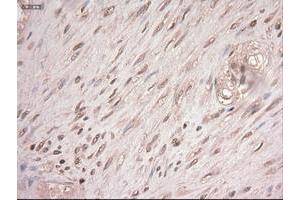 Image no. 8 for anti-Myc Proto-Oncogene protein (MYC) antibody (ABIN1497011) (c-MYC 抗体)