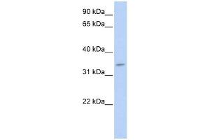 Tenomodulin antibody used at 1 ug/ml to detect target protein. (TNMD 抗体  (N-Term))