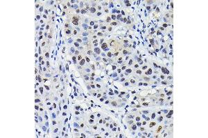 Immunohistochemistry (IHC) image for anti-Karyopherin alpha 3 (Importin alpha 4) (KPNA3) (AA 1-210) antibody (ABIN6142991)