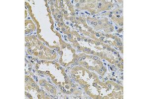 Immunohistochemistry of paraffin-embedded human kidney using PPID Antibody (ABIN5974177) at dilution of 1/100 (40x lens). (PPID 抗体)