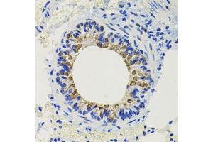 Immunohistochemistry of paraffin-embedded mouse lung using CALB2 antibody. (Calretinin 抗体)