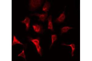 ABIN6269136 staining HepG2 by IF/ICC. (FGFR1 抗体  (C-Term))